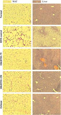 18KHT01, a Potent Anti-Obesity Polyherbal Formulation